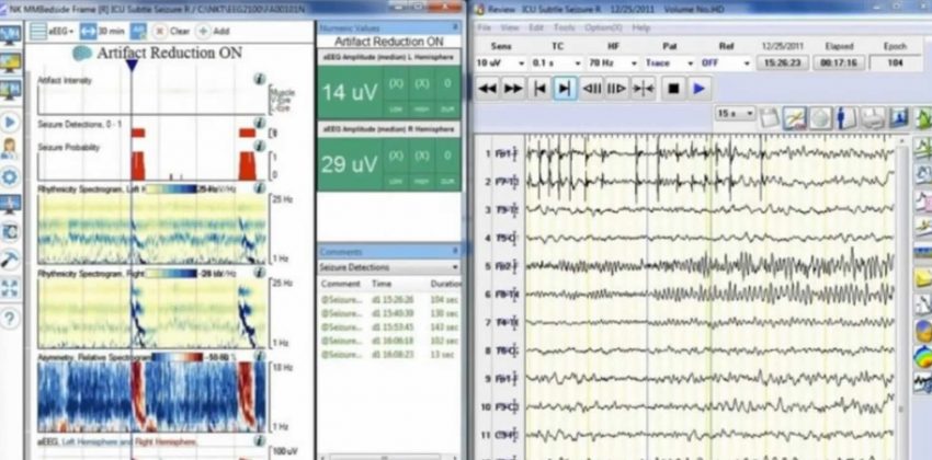 NKA EEG Acquisition – A Historical Perspective 2022