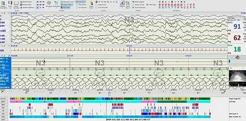 Polysmith 12:  Navigating the Dashboard and Recording Sleep Studies